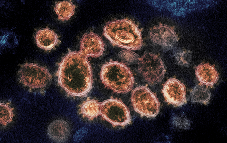 Coronavirus: Explained